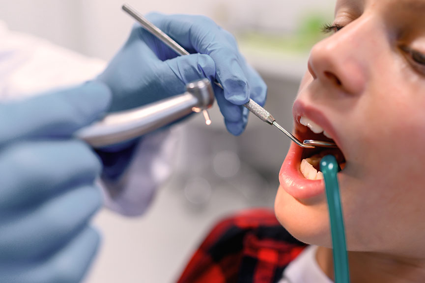 Cómo prevenir caries en los niños
