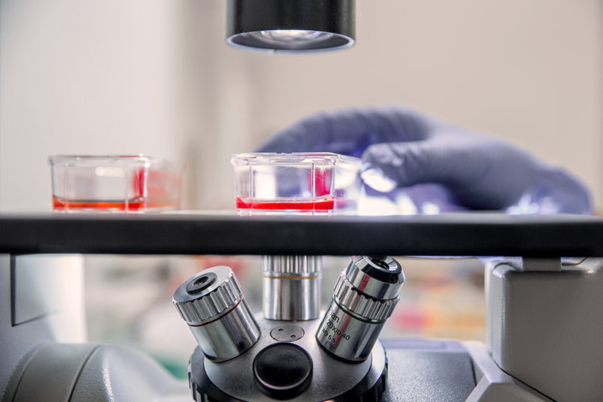 Qué es la citofagia