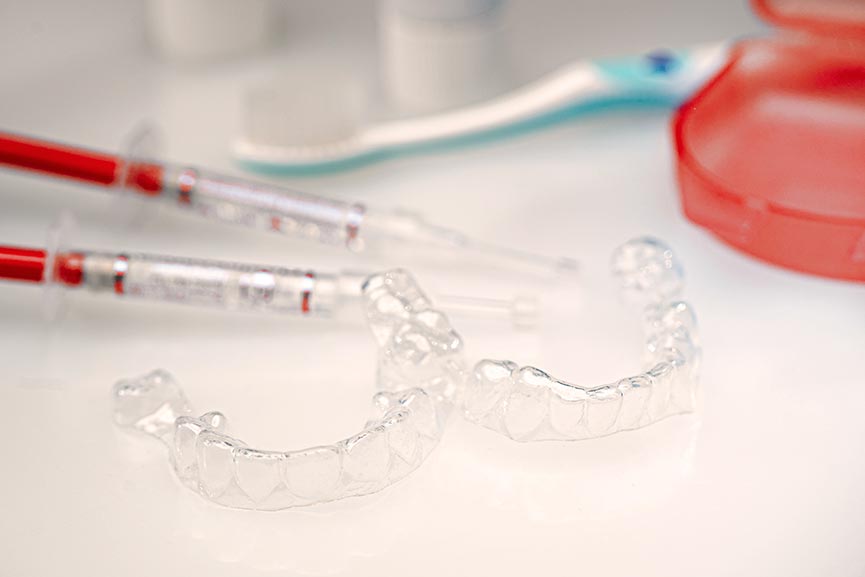 Blanqueamiento Dental