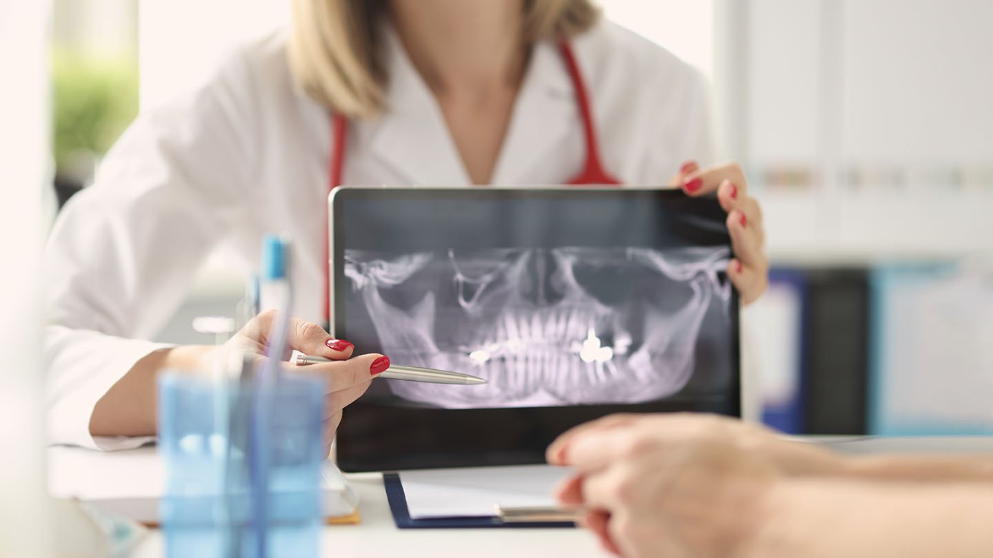Dentista enseñando radiografía dentadura