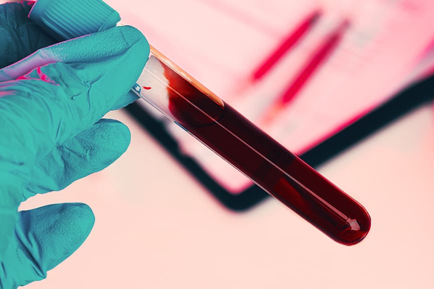 Análisis hemoglobina