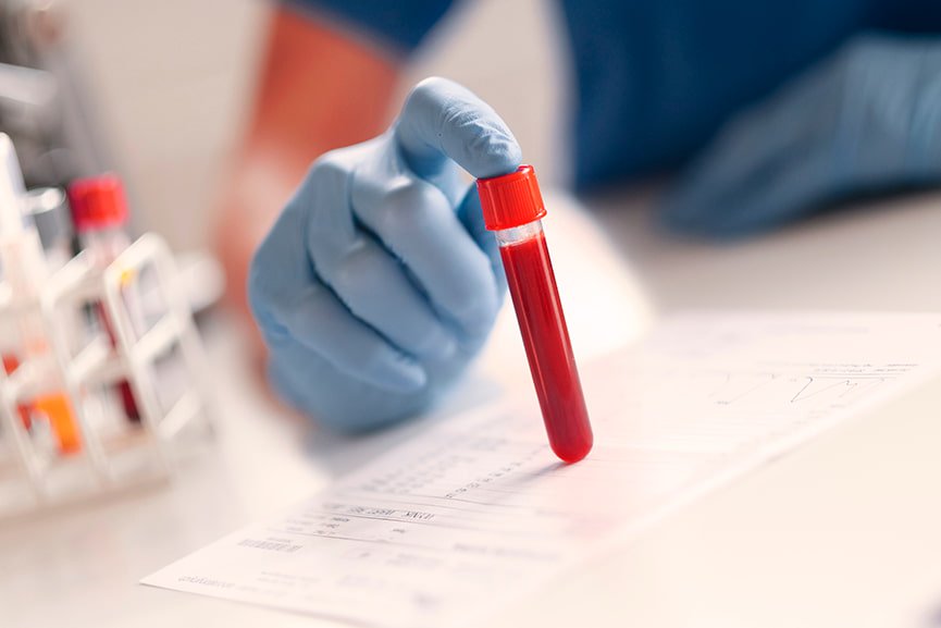 Hematocrito